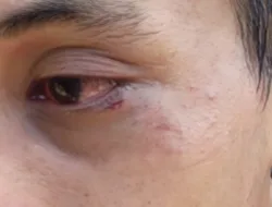 Aksi GAM di Makodam XIV Hasanuddin Makassar Berujung Tindakan Represif