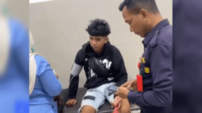 Pemuda di Takalar Diserang Geng Motor, Telapak Tangan Tertancap Busur Panah
